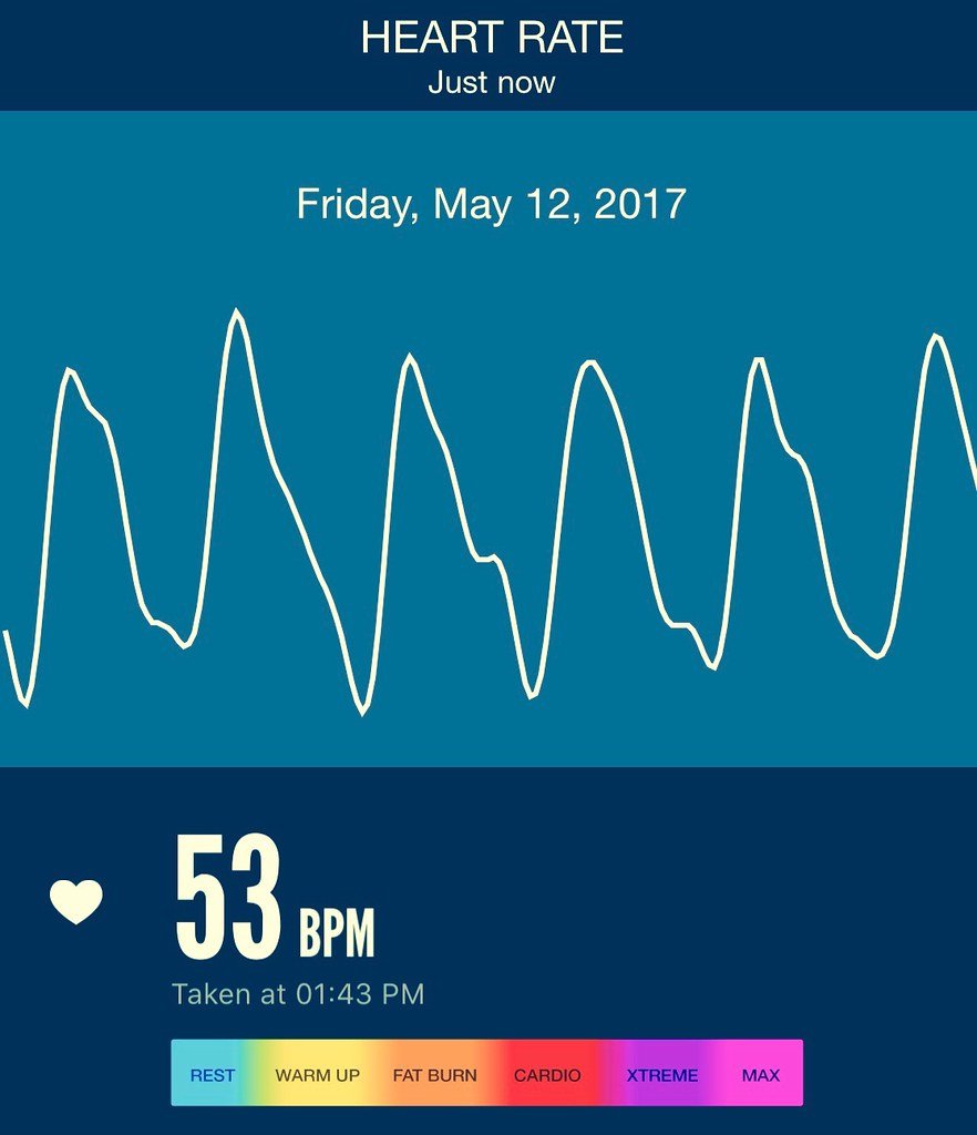 The Power of Nap Time Cardio: A Refreshing Fitness Routine⁣ for ⁤New Moms